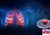 A lab breakthrough by researchers at The University of Adelaide